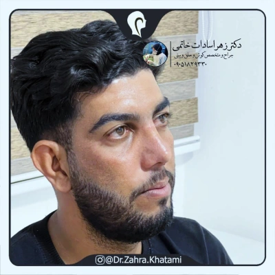نمونه کار دکتر زهرا خاتمی