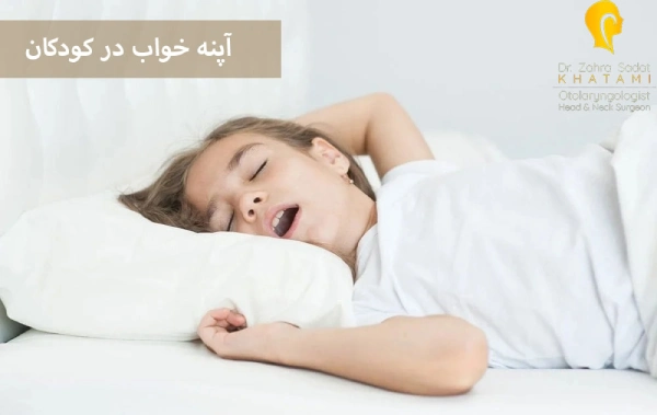 آپنه خواب در کودکان