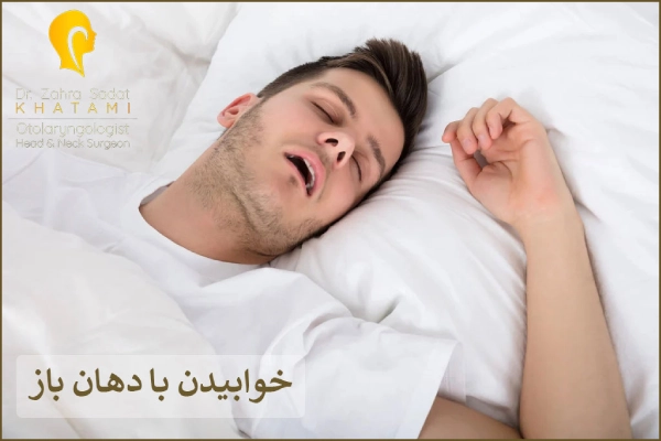 خوابیدن با دهان باز