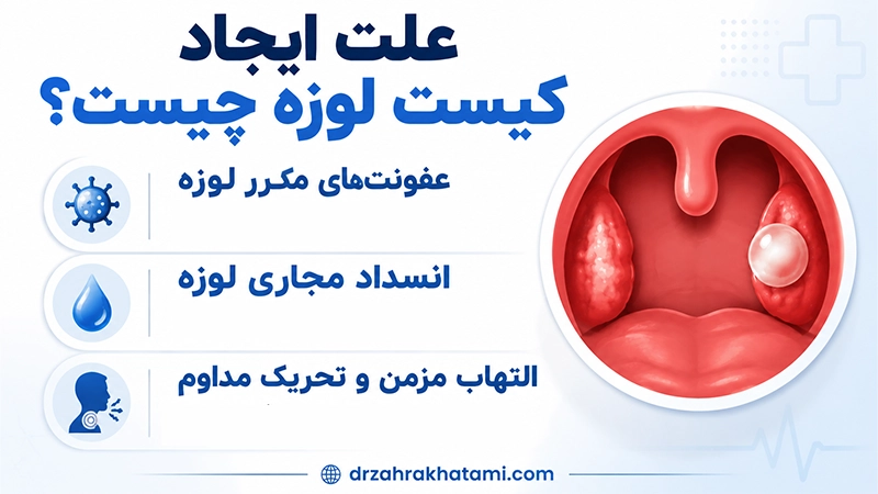 علت ایجاد کیست لوزه