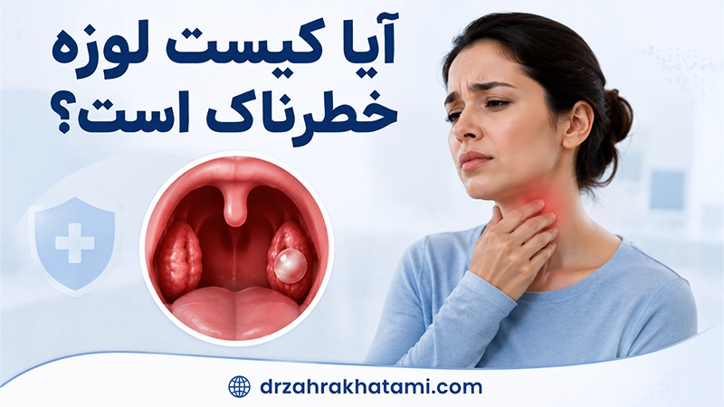 کیست لوزه خطرناک