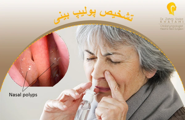 تشخیص پولیپ بینی