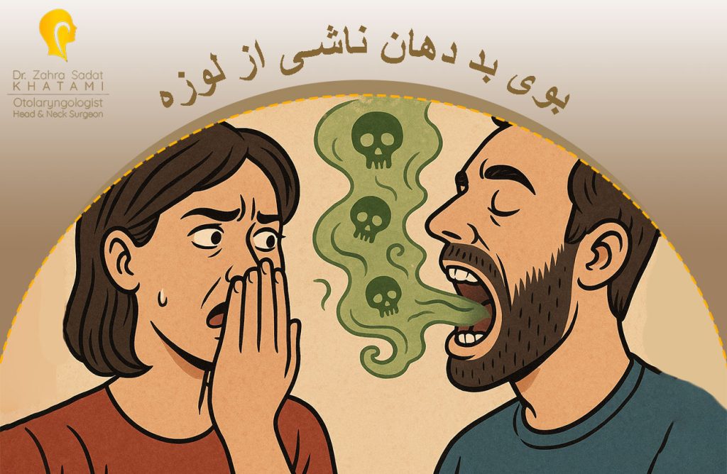 بوی بد دهان ناشی از لوزه